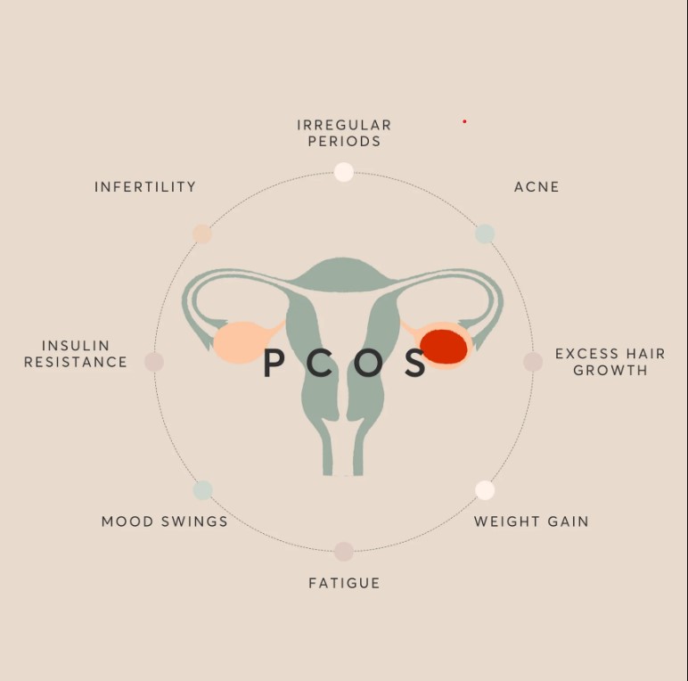 Best Doctor For PCOD And MENSTRUAL Problem in Sambhaji Nagar